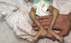 İsrail'in kıtlığı dayattığı Gazze'de bir bebek daha açlıktan can verdi