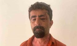 Gelin Krizi Kanlı Bitti: Kayınpeder 13 Dikişle Kurtuldu