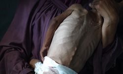 Gazze "açlıktan" ölüyor