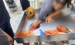 Elini salça makinesine kaptırdı!