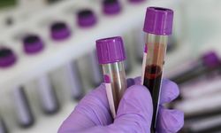 Kan kanserinde 'immünoterapilerle' tedavide yeni dönem