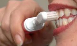 “Dişlerinizi Yanlış mı Fırçalıyorsunuz? Uzmanlardan 4 Kritik Uyarı