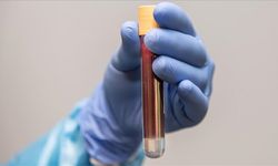 Kardeşinde prostat kanseri öyküsü olanlara 45 yaşından itibaren tarama önerisi