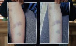 Özel okulda 8 yaşındaki çocuğun darbedildiği iddiası