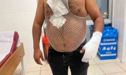 Meşhur tostçu, soğuk havada şov yapmak isterken kendini yaktı