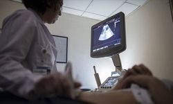 Her 10 kadından biri 'çikolata kisti' ile yaşıyor