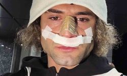 Elazığspor'da Fuat Bavuk'un burnu kırıldı