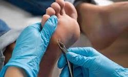 Nasır ve Egzamaya Veda! Doğal Çözüm Bulundu