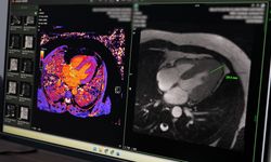 Malatya'da Sağlıkta Büyük Yükseliş! İleri Görüntüleme Teknolojileri Bölgenin Merkezi Oldu