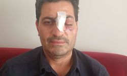 Malatya’da Müezzine Çirkin Saldırı: Burnunu Kırdılar!
