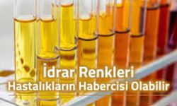 İdrar Rengindeki Koyulaşma Bakın Neyin Habercisi Olabilir..
