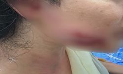 Diyarbakır’da Maç Kutlaması Felakete Döndü! Havai Fişek 2 Kardeşi Yaraladı