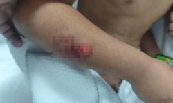 Eve Giderken Köpeklerin Hedefi Oldu! Küçük Çocuğun Başına 15 Dikiş Atıldı