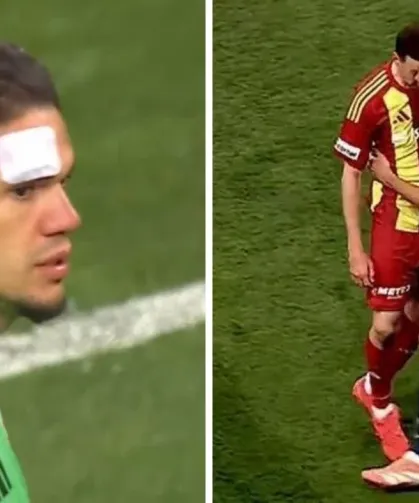 Kayseri'de Maç Bir Anda Karıştı! Tribünden Atılan Madde Ederson’u Kanlar İçinde Bıraktı