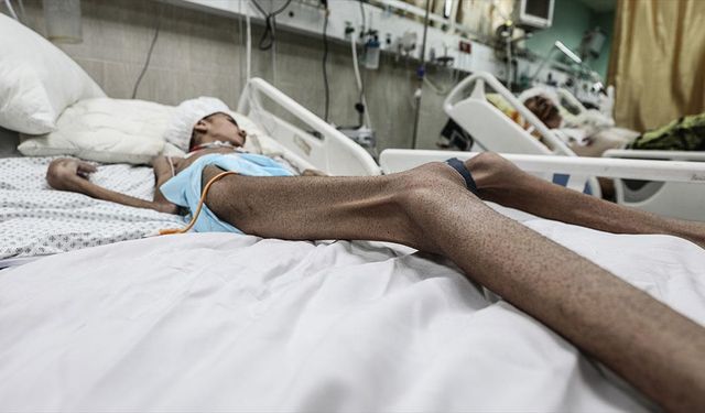 İsrail'in kıtlığı dayattığı Gazze'de son 24 saatte 6 kişi daha açlıktan hayatını kaybetti