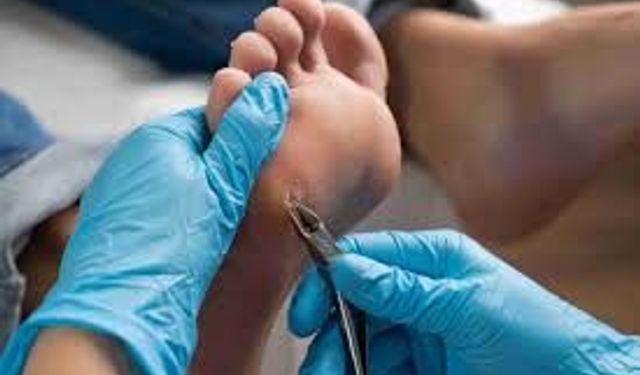 Nasır ve Egzamaya Veda! Doğal Çözüm Bulundu