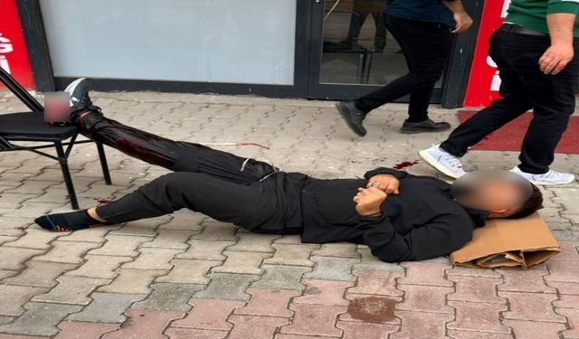 Yürürken Hedef Oldu! Araçla Yanına Yaklaşıp Ateş Açtılar: 32 Yaşındaki Adam Vuruldu