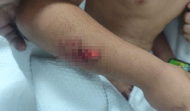 Eve Giderken Köpeklerin Hedefi Oldu! Küçük Çocuğun Başına 15 Dikiş Atıldı