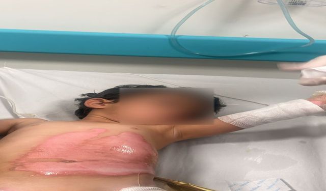 3 Yaşındaki Kızın Üzerine Kaynar Su Döküldü! Hastaneye Kaldırıldı