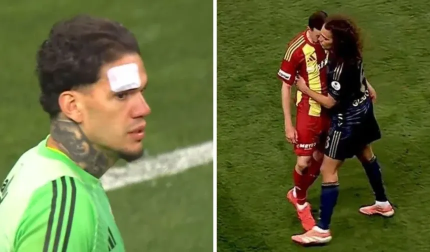 Kayseri'de Maç Bir Anda Karıştı! Tribünden Atılan Madde Ederson’u Kanlar İçinde Bıraktı