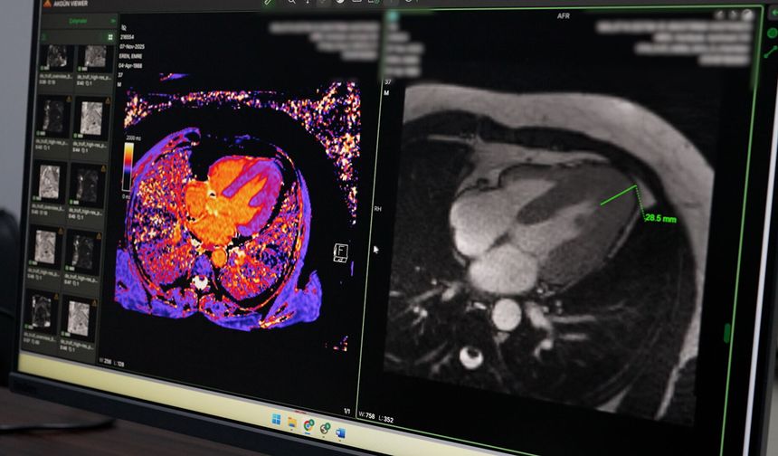 Malatya'da Sağlıkta Büyük Yükseliş! İleri Görüntüleme Teknolojileri Bölgenin Merkezi Oldu